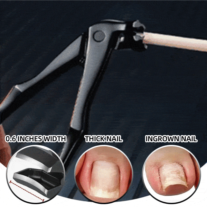 Viveala™ ToeClip Pro