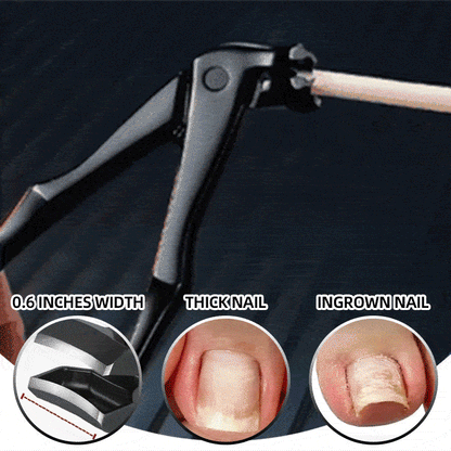 Viveala™ ToeClip Pro